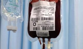 直系亲属可以输血吗 为什么不允许直系血亲献血